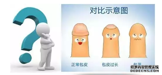 马鞍山问一件羞羞事!小儿包皮过长,要不要割呀!
