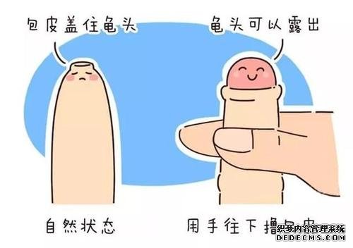 马鞍山包皮过长引起男性朋友勃起困难!