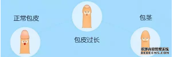 马鞍山哪个医院做包皮