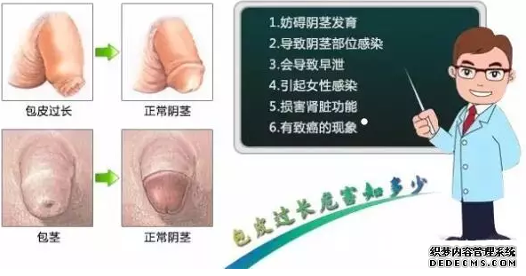 马鞍山含山县包皮过长的并发症